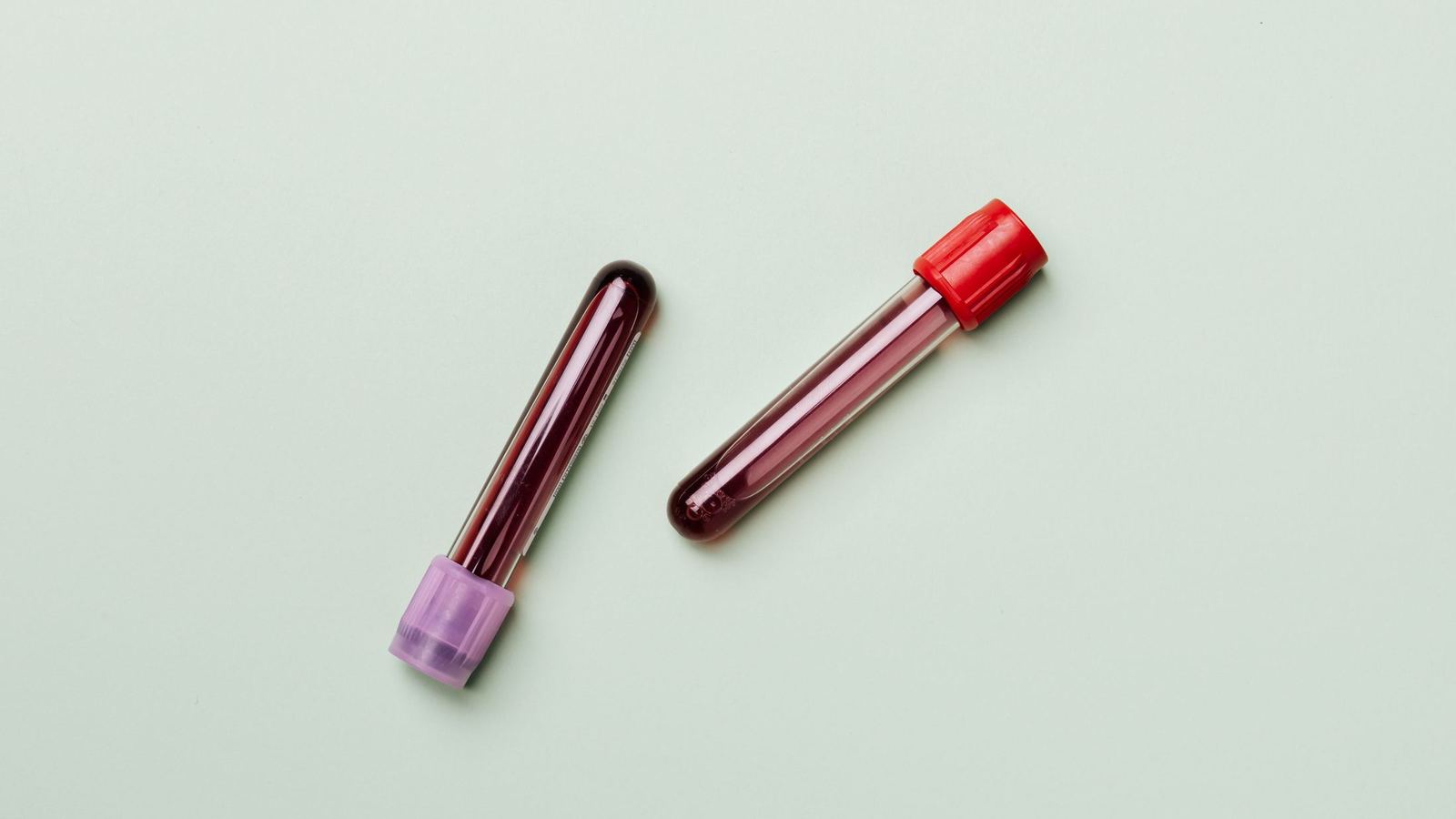 Two blood sample tubes on a light background