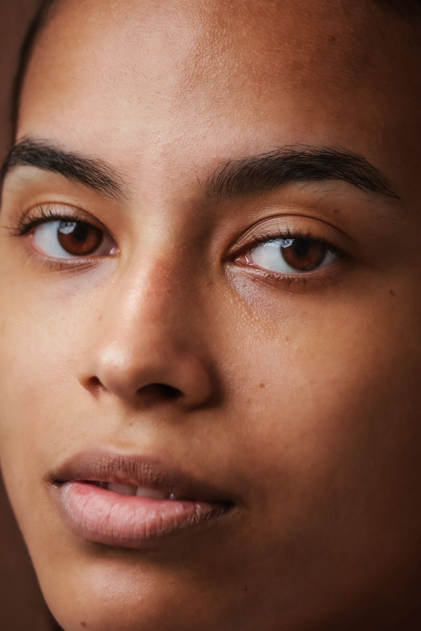 Forehead and frown line area treated with Toxin