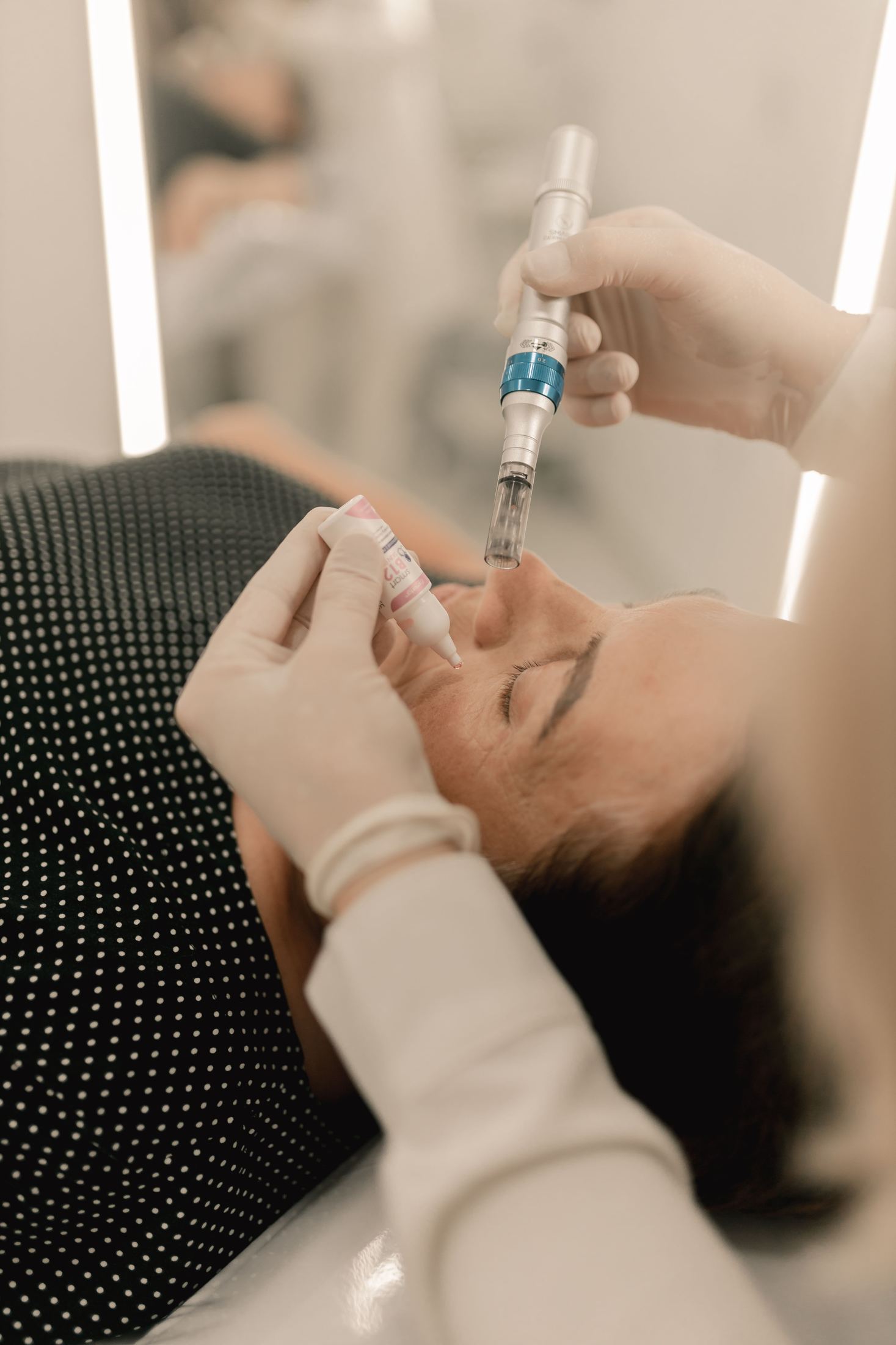 A microneedling treatment being performed on a patient's face
