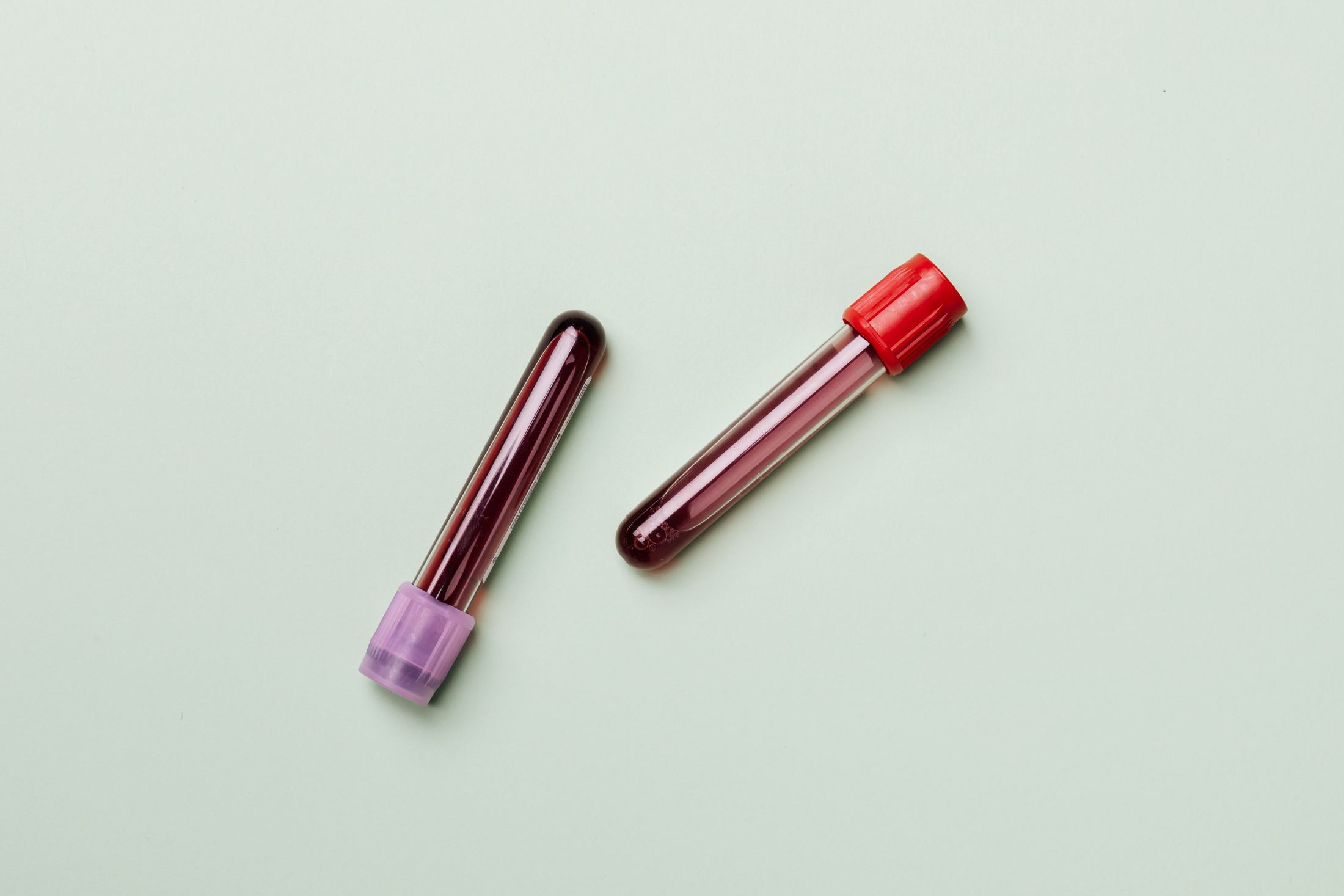 Blood test tubes ready for lab work